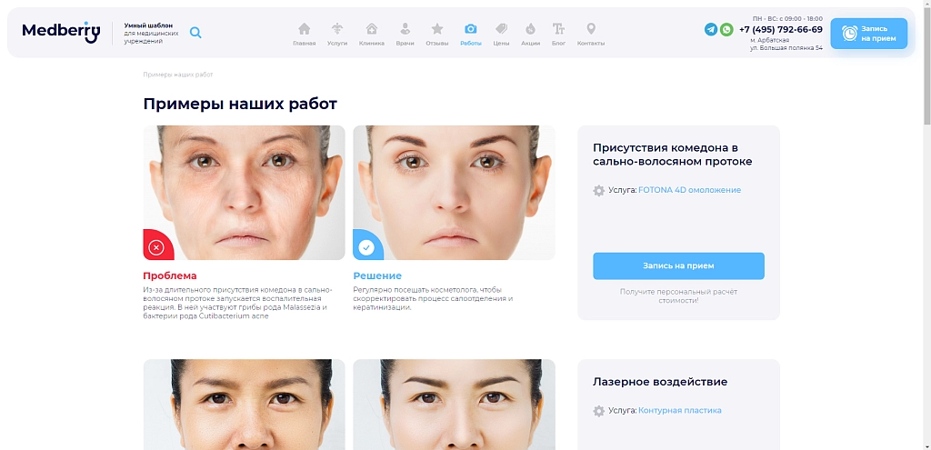 Купить Medberry: Быстрый и легкий шаблон для клиник